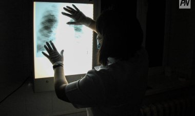 Павлодарцы смогут бесплатно провериться на рак легких