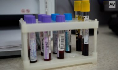 Жапонияда толығымен роботтар басқаратын медициналық зертхана іске қосылды