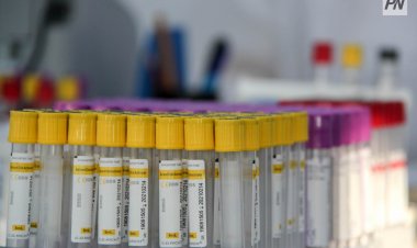 Где в Павлодарской области чаще гриппуют