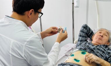 Врачи вытащили из павлодарца камни размером с гречку